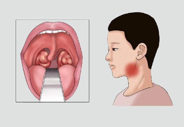 白叟吃不下怎么办？5个小好方法帮你来应对